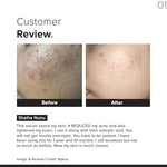 Minimalist Essential Bundle: 10% Niacinamide Serum with Zinc (30ml) for Oil Control & Acne + 10% Vitamin C Serum (30ml) for Dark Spots & Glow + SPF 50 PA++++ Sunscreen (50g) image 9 — view 9