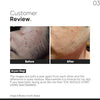 Minimalist Niacinamide 10% + Vitamin C 10% Face Serum Combo | Acne Marks, Dark Spots, Oil Control & Skin Brightening | Pore Minimizing & Glow Boosting Skincare | Oily, Combination & Acne Prone Skin image 10