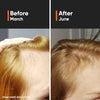 Minimalist Hair Growth Serum With 3% Redensyl, 3% Anagain, 3% Procapil, 5% Capixyl & 4% Baicapil 18% Hair Growth Actives | For Hair Fall Control | For Men & Women | 30 ml image 9