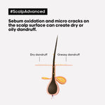 L'Oréal Professionnel Scalp Advanced Anti-Dandruff Dermo-Clarifier Shampoo 300 Ml & Liss Unlimited Hair Mask with Pro-Keratin for Rebellious Frizzy Hair. image 4 — view 4