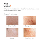 Minimalist Niacinamide 10% Serum with Zinc + B5 Moisturizer | Acne Marks Reduction, Oil Control, Hydration & Skin Barrier Repair Skincare Combo for Oily & Acne-Prone Skin image 8 — view 8