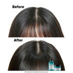 L’Oréal Professionnel Scalp Advanced Anti-Oiliness Dermo-Purifier Shampoo 300 ml + L’Oréal Professionnel Scalp Advanced Anti-Oiliness 2-In-1 Deep Purifier Clay 250 gm | For Oily Scalp image 4 — view 4