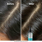 L'Oreal Professionnel Scalp Advanced 5-In-1 Leave-In Hair Serum - 90ml | Defeats 5 scalp irregulations (Oiliness, Discomfort, Sweat, Impurities & Odor)| L'Oreal Serum for Men & Women image 3 — view 3